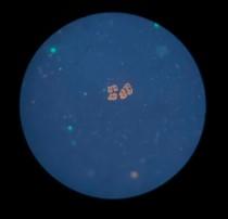 microscope image of  microbe C. watsonii